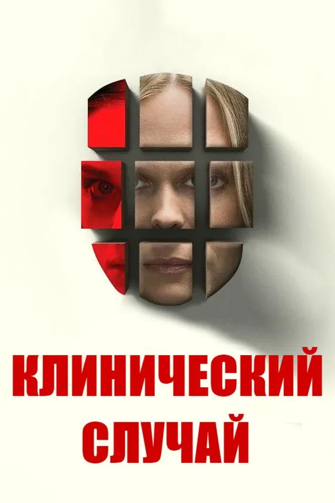 Постер фильма Клинический случай